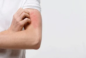 https://clinicahispanafamiliarrosenbergtexas.com/wp-content/uploads/2024/04/Diagnosis-and-Treatment-of-Skin-Rashes-min.png.webp