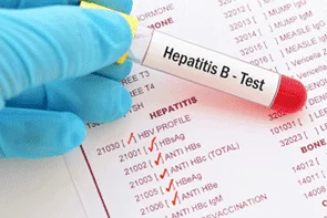 https://clinicahispanafamiliarrosenbergtexas.com/wp-content/uploads/2024/04/Hepatitis-B-Diagnostic-Test-min.png.webp