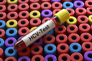 https://clinicahispanafamiliarrosenbergtexas.com/wp-content/uploads/2024/04/Hepatitis-C-Diagnostic-Test-min.png.webp